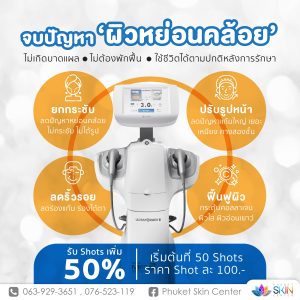 ยกกระชับ ภูเก็ต Ultraformer III
