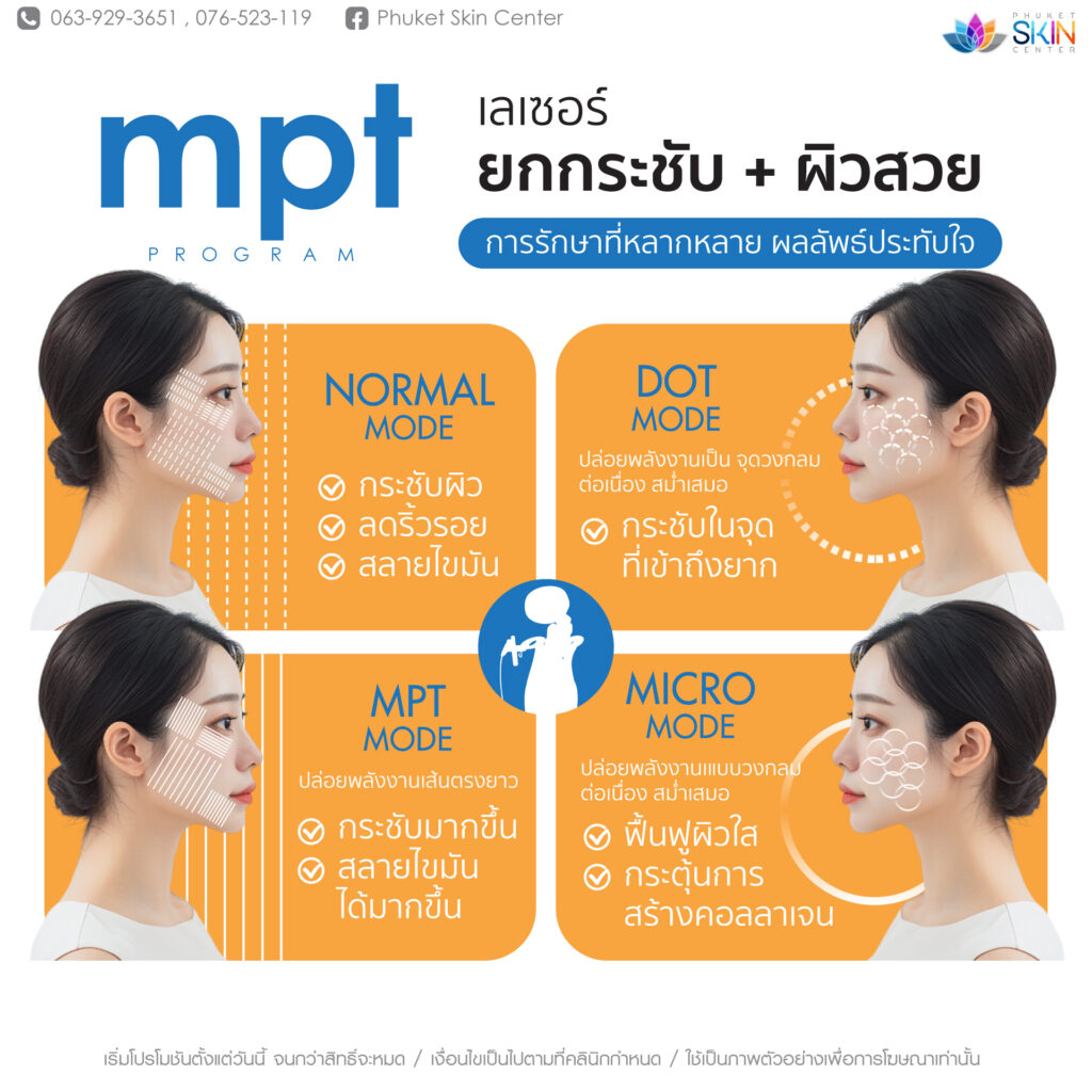 481702909_1262454328779826_4213390692816335843_n เลเซอร์ปรับรูปหน้า ภูเก็ต Ultraformer MPT