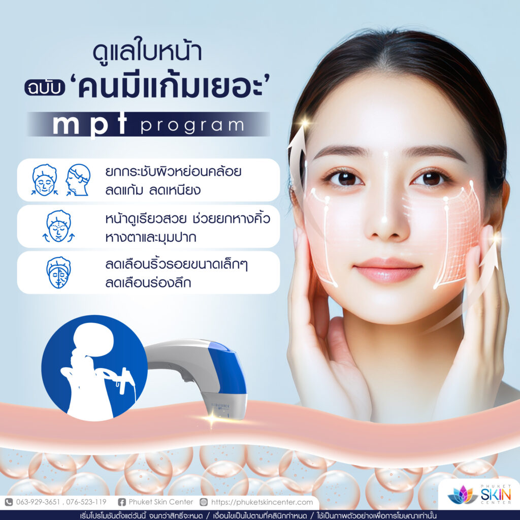482227658_1273251337700125_822100549642215626_n ปรับรูปหน้า ลดแก้ม ภูเก็ต