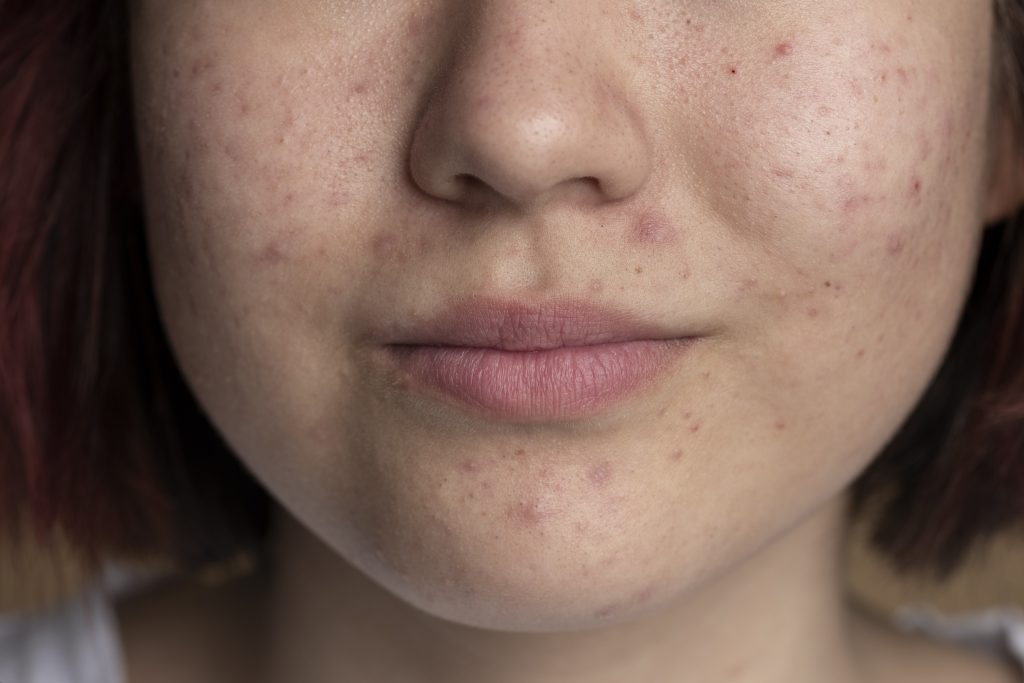 close-up-skin-pores-face-care-routine