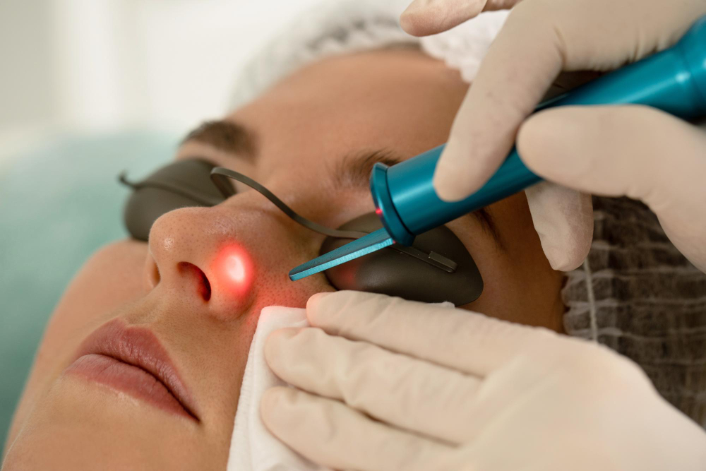 mole-removal-in-clinic