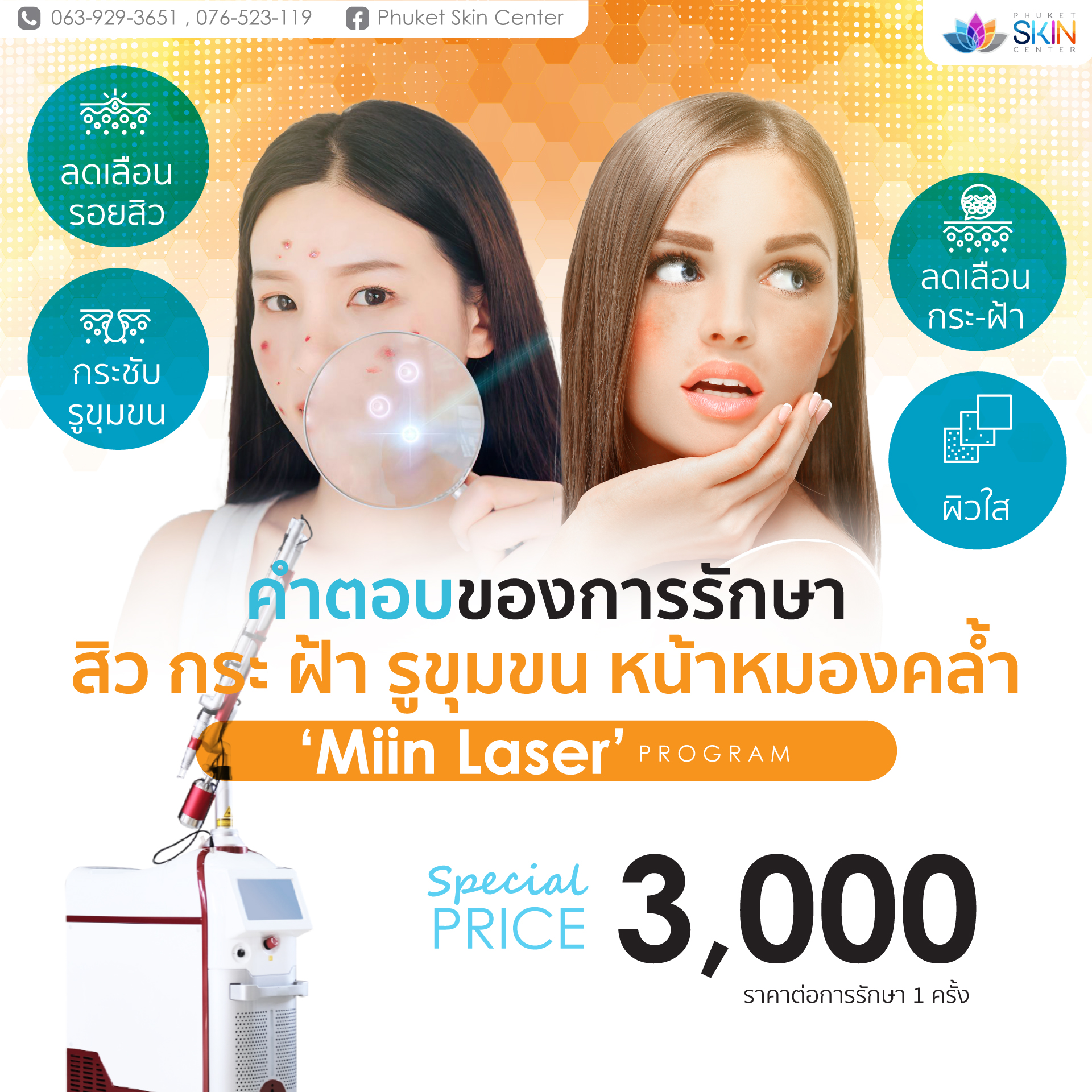 โปรรักษาผิวหน้า miin laser