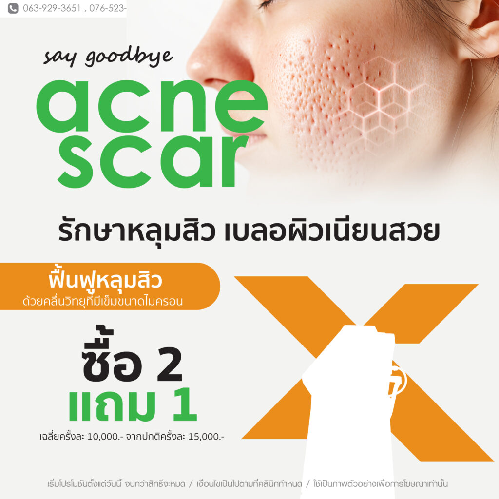 โปร รักษาหลุมสิว